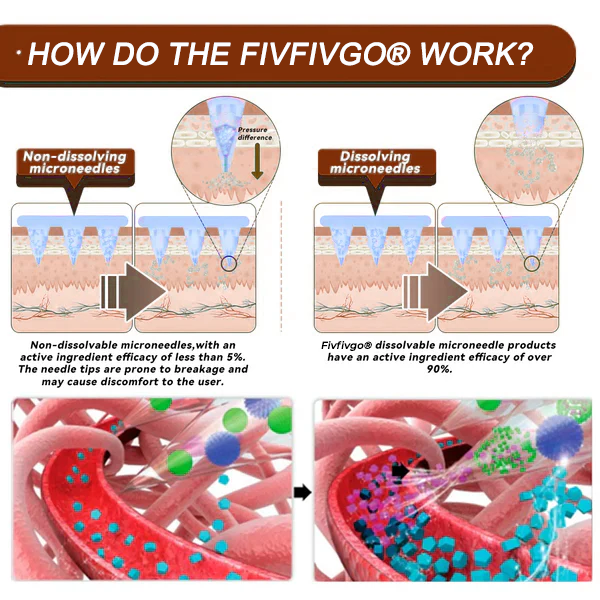 Fivfivgo® Botox Bee Venom Microneedle Patch (Painless, Long-Lasting Treatment for Stubborn Wrinkles and Skin Concerns)