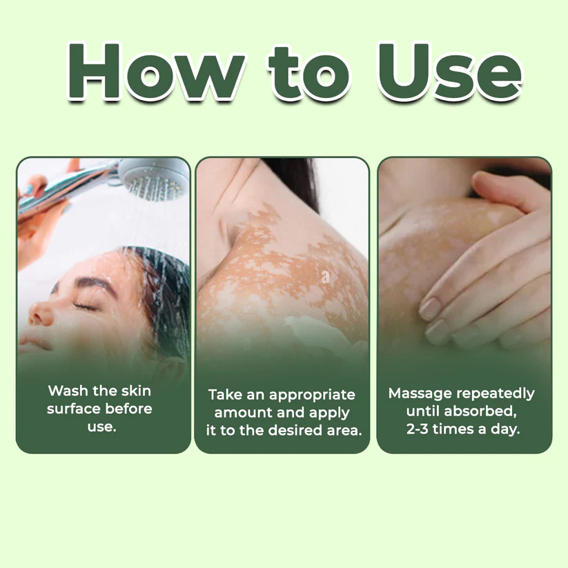 Fivfivgo® Vitiligo Treatment Ointment