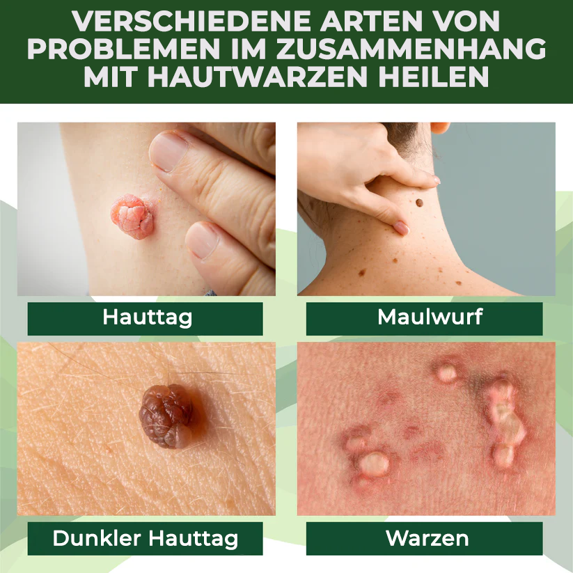 Fivfivgo® Reedle Shot 100 Tag & Spot Zielscheibe Fortgeschrittenes Serum