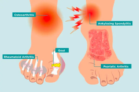 Fivfivgo™ Bee Venom Advanced Joint and Bone Therapy Cream (New Zealand Bee Extract - Specializes in Orthopedic Diseases and Arthritis Pain)