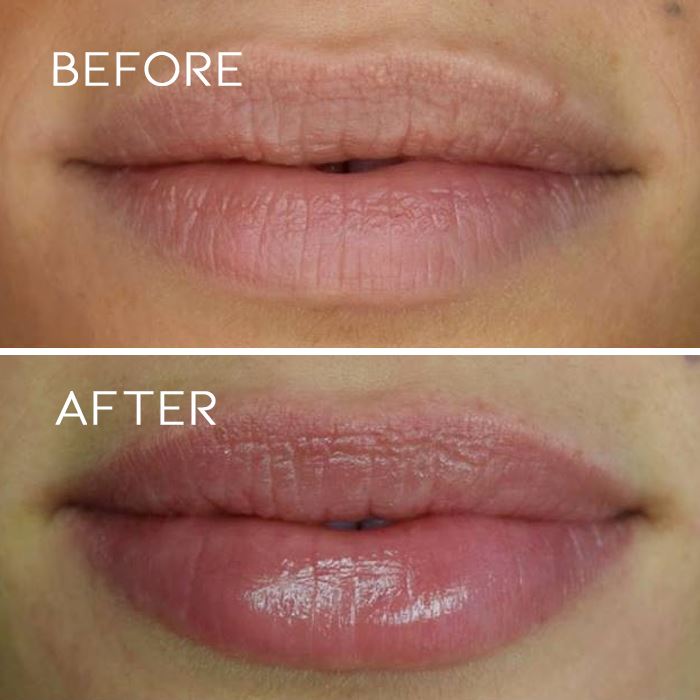 Honey Deep Moisturizing Lip Mask Personal Care Every Day And Night 