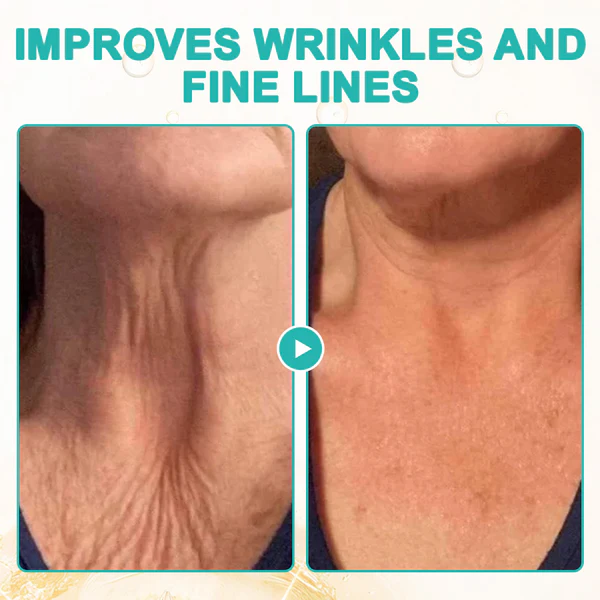Fivfivgo™ Luxilift Collagen-Powered Firming Body Massage Oil