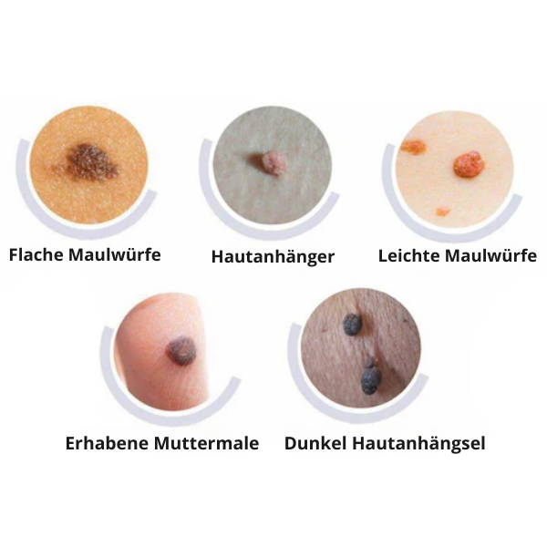 Fivfivgo™ WipeOff Tags & Maulwurfsentferner