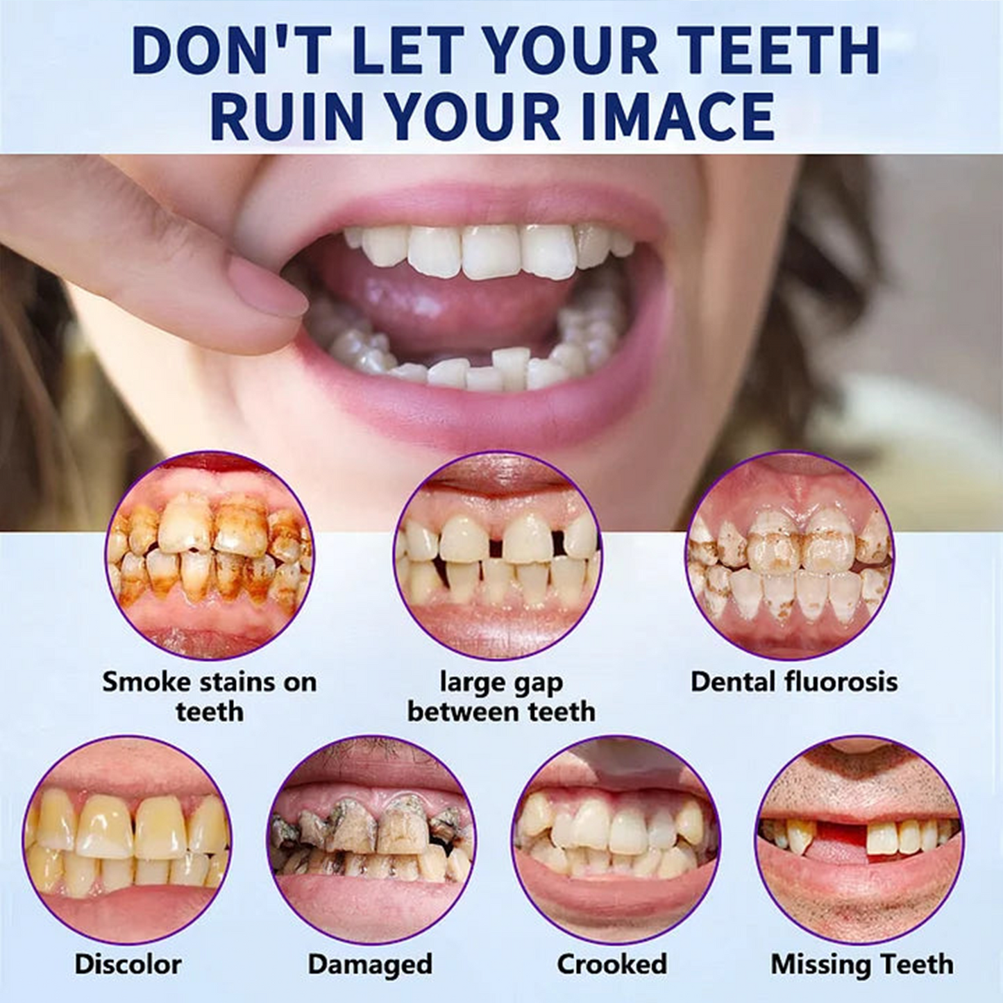 Bikenda® Advanced Customised Full Denture Set