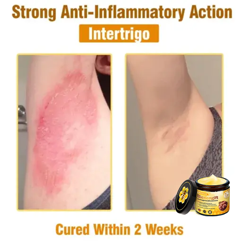 Fivfivgo™ Bee Venom Skin Regeneration Cream