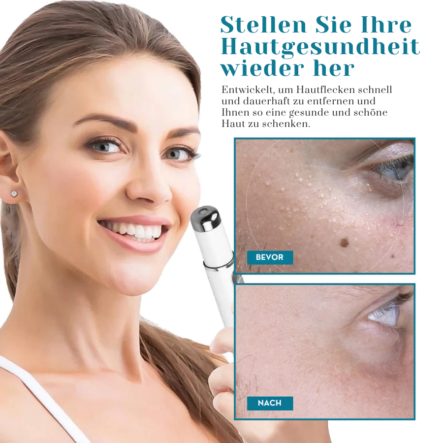 Bikenda® LumeSkin Muttermal und Warze Entfernung Laserstif
