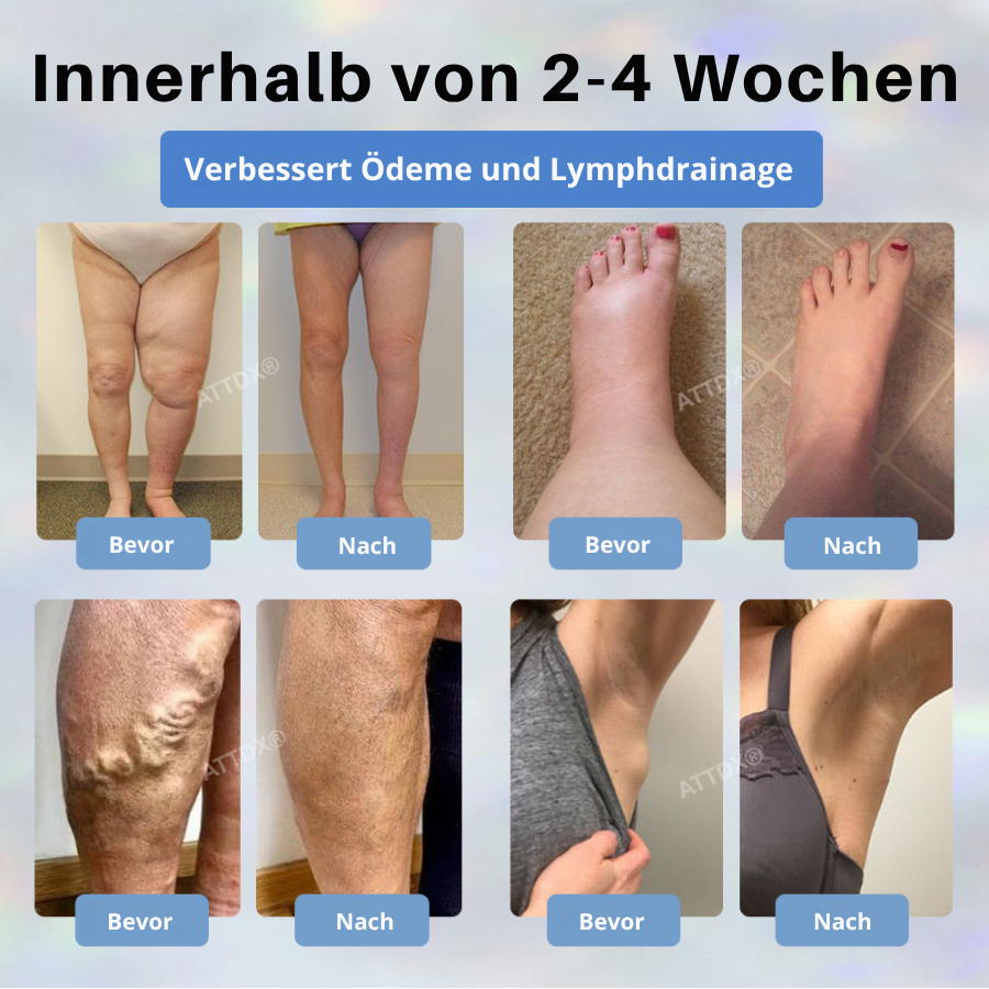 Fivfivgo® Schwarzkümmel Ödeme lindernde Kräutercreme