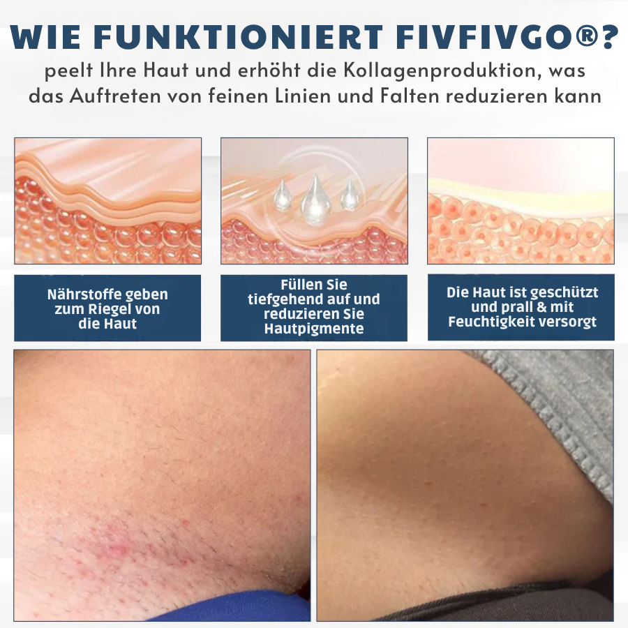 Fivfivgo® LicorRelief Mann Genital Antimykotisch Creme