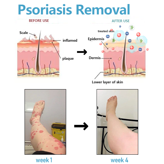 Fivfivgo™ Tourmaline Ions Magneettikuitu Ice Silk sukat