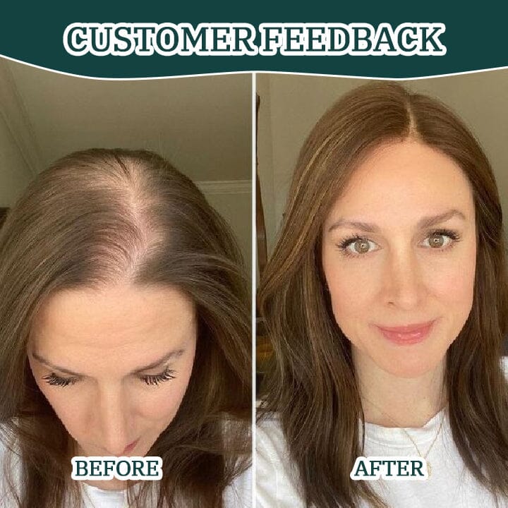Fivfivgo™ CentellaGrowth Gommage du cuir chevelu