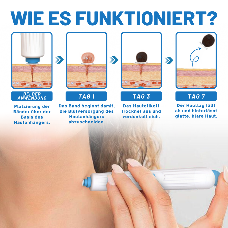 Fivfivgo™ Zu Hause Haut Tag Einfädeln Stift