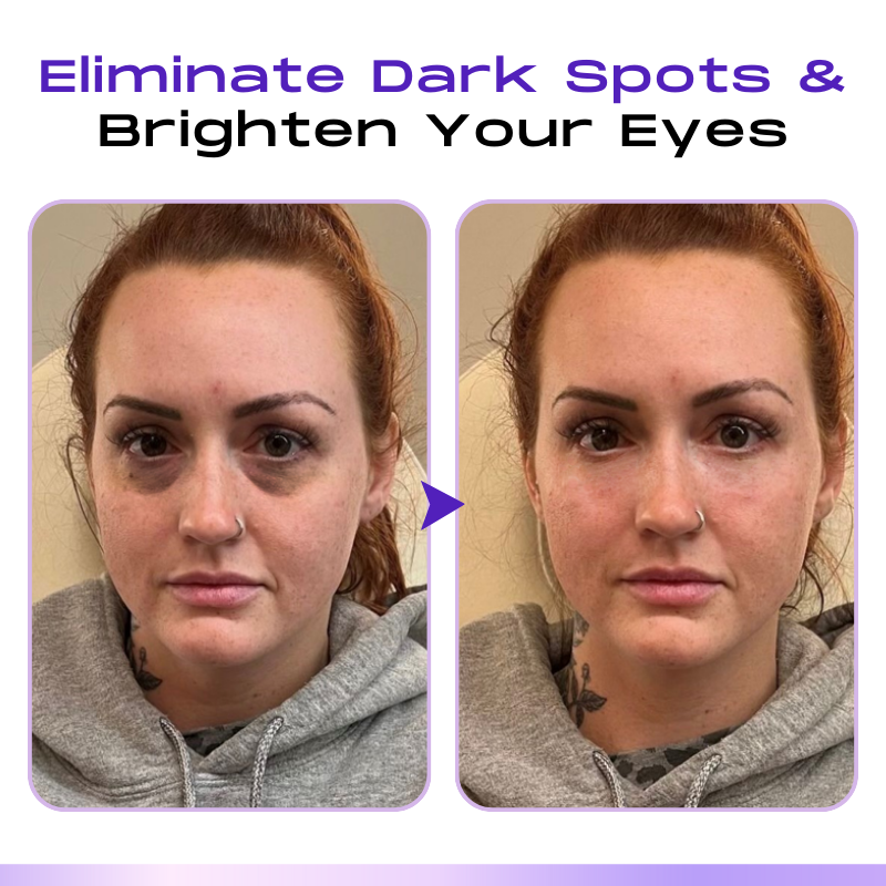 Fivfivgo™ CollagenVen Bee Venom Eye Roller Serum👨‍⚕️US Dermatologist Approved