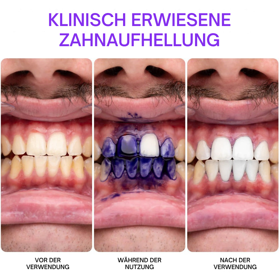 Fivfivgo® Farb Korrektor Serum | Klinisch erwiesen, dass es Flecken sanft entfernt, die Zähne aufhellt und den natürlichen Glanz in nur 3 Tagen wiederherstellt - sicher für empfindliche Zähne und Zahnschmelz