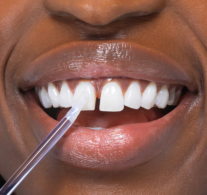Fivfivgo™ NiceSmile Teeth Whitening Essence