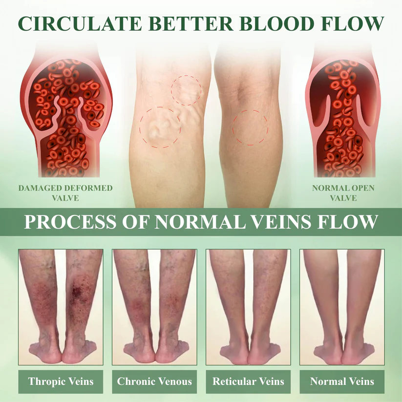 Fivfivgo™ SwellSoothe Lymphatische Creme
