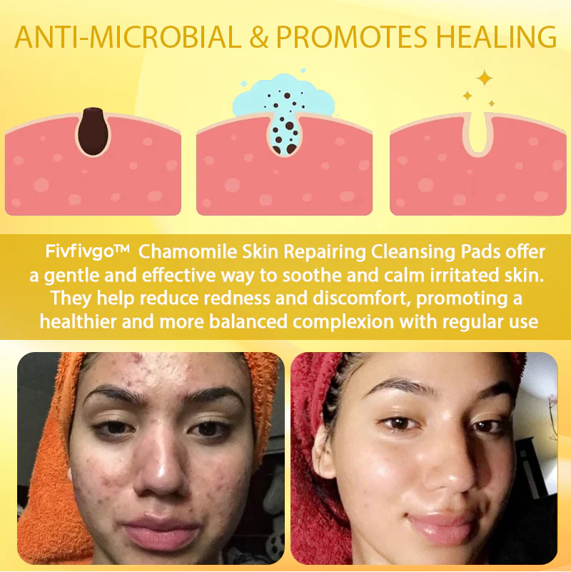 Fivfivgo™ Chamomile Skin Repairing Cleansing Pads