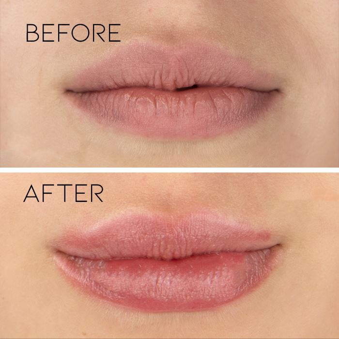 Lip Reboot Exfoliator Morning Shades 