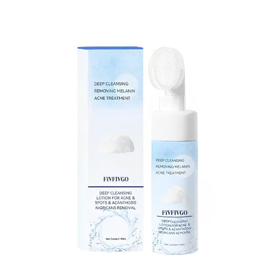 Fivfivgo™ Deep Cleansing Lotion for Acne & Pimples & Acanthosis Nigricans Removal