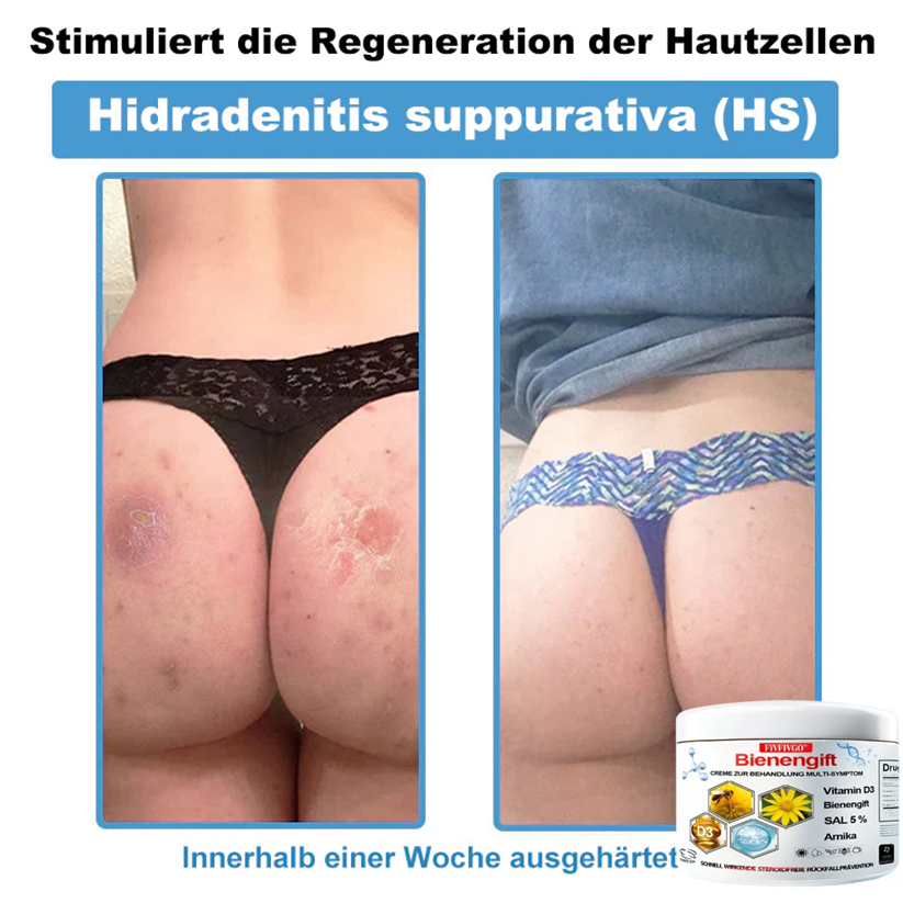 Fivfivgo™ Bienengift Creme Zur Behandlung Multi-symptom