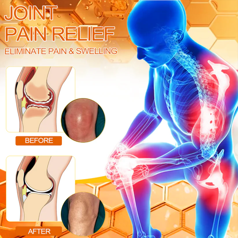 Fivfivgo™ Bee Venom Arthritis Therapy Cream (Specially for older adults & AAOS recommends)