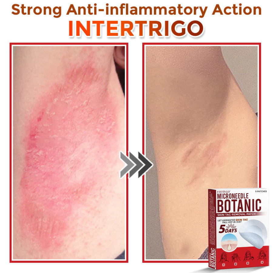 Fivfivgo® MicroNeedle Botanic Skin Tag Removal Patch 🇺🇸 Made in the USA