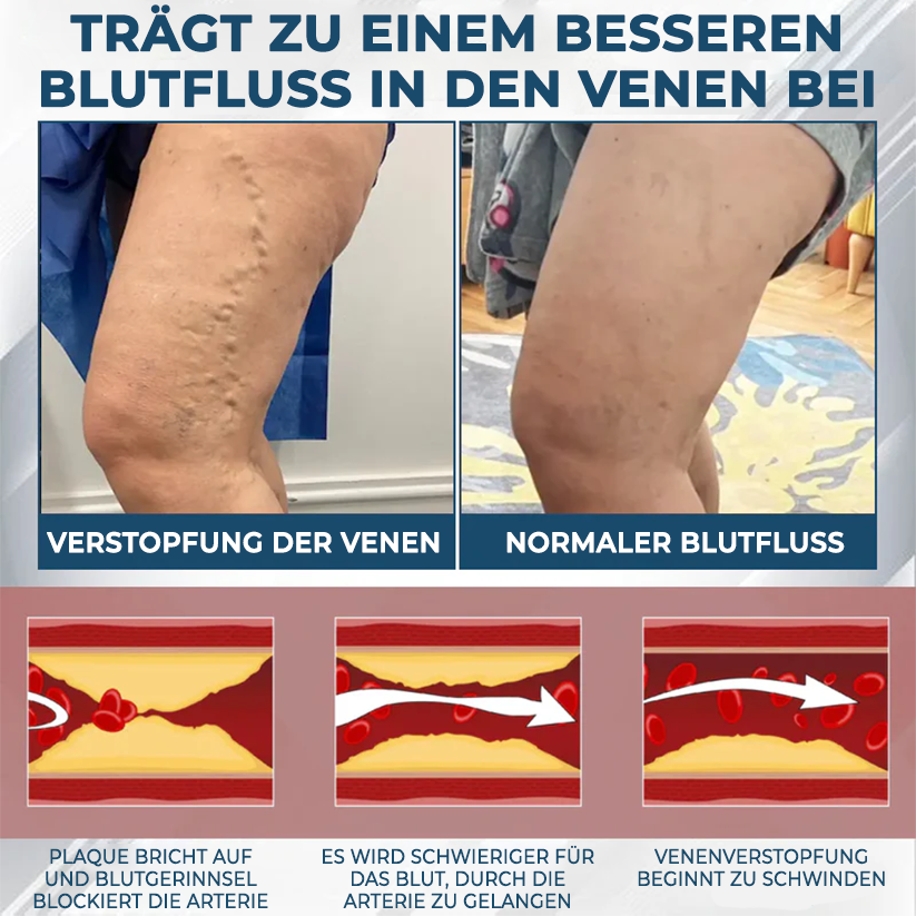 Fivfivgo® VenoHerb Schwarzkümmel-Ödemlöser-Balsam