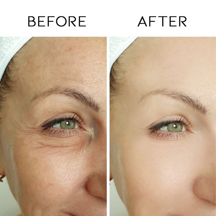 Retinol Anti-Ageing Cream Personal Care Every Day And Night 