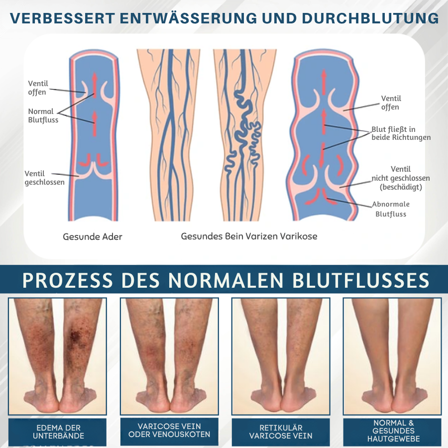 Fivfivgo® Schwarzkümmel Ödeme lindernde Kräutercreme