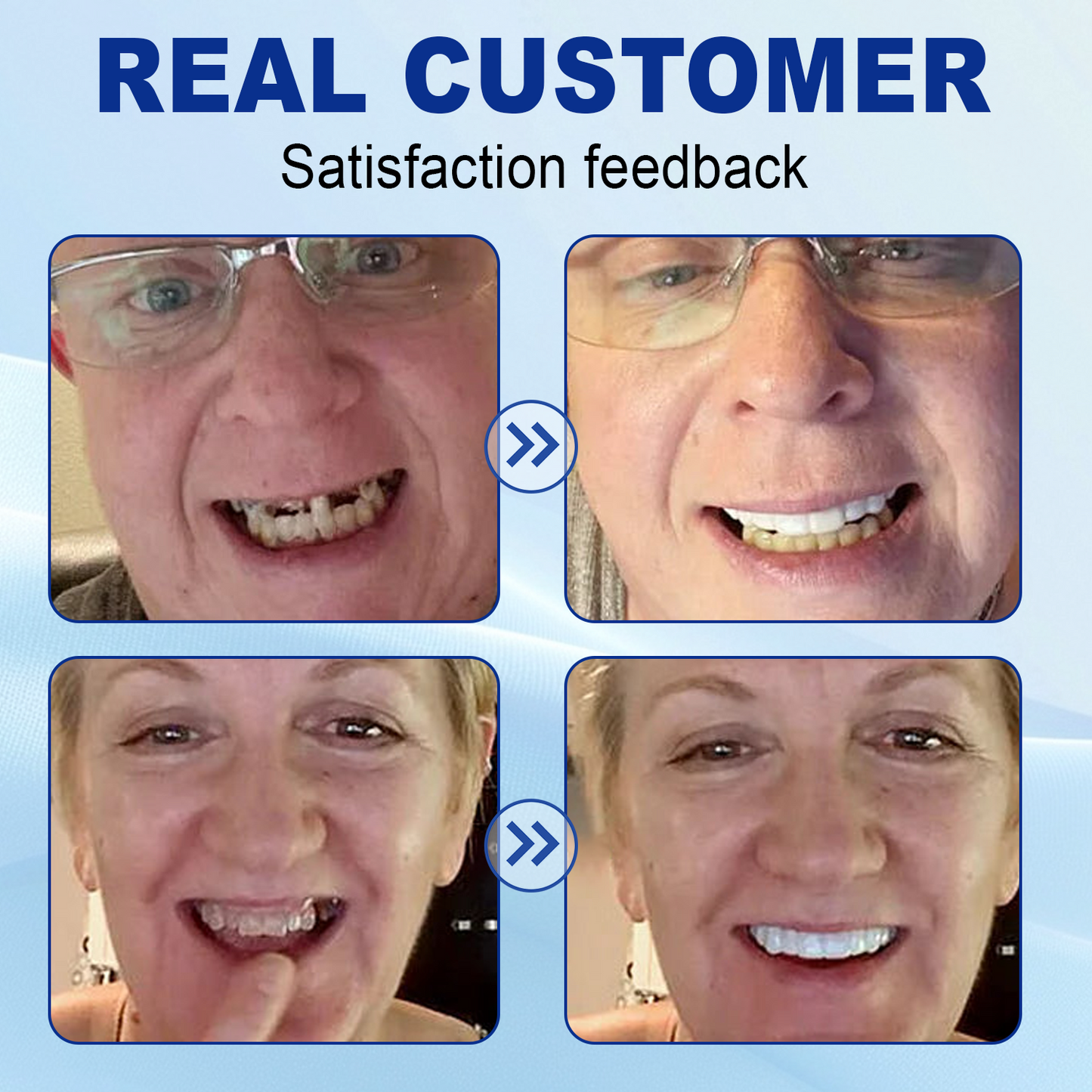 Bikenda® Advanced Customised Full Denture Set