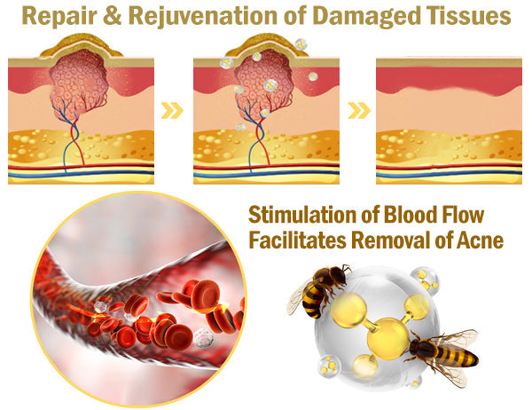 Fivfivgo™ Powerful All-Body Skin Treatment
