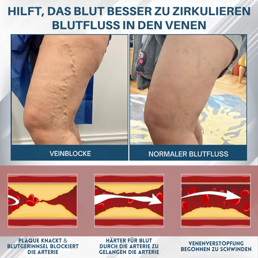 Fivfivgo® Schwarzkümmel Ödeme lindernde Kräutercreme