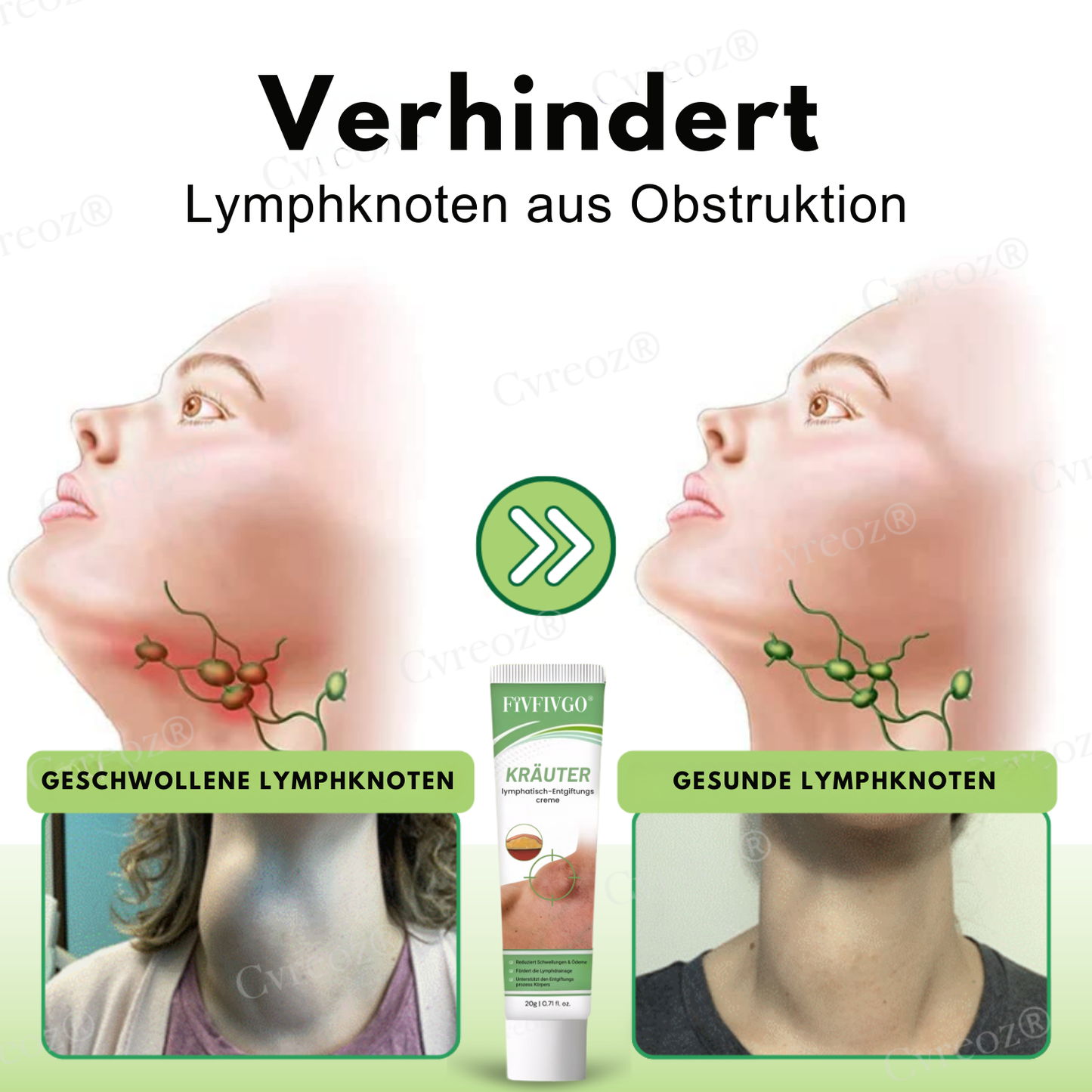 Fivfivgo® Kräuter-lymphatisch-Entgiftungscreme