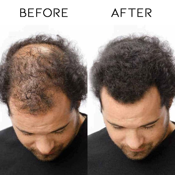 Hair Growth & Volume Serum Roller Hair Styling Tools Every Day And Night 