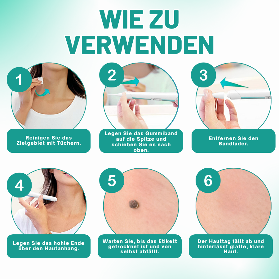 Fivfivgo™ 2-in1 Haut Tag Entfernung Kit