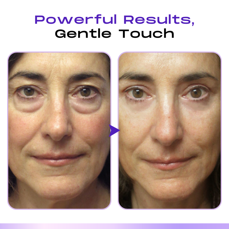 Fivfivgo™ CollagenVen Bee Venom Eye Roller Serum👨‍⚕️US Dermatologist Approved