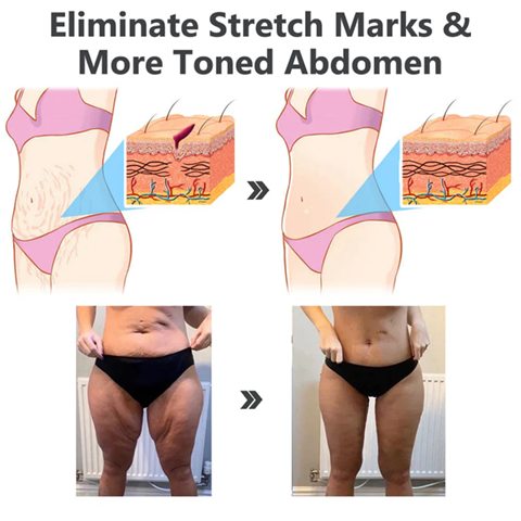 Fivfivgo™ Flüssiges Peptid-Peeling-Essenz