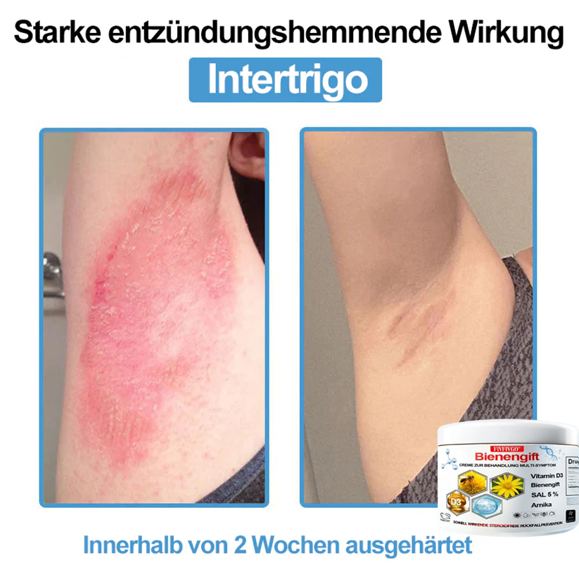 Fivfivgo™ Bienengift Creme Zur Behandlung Multi-symptom