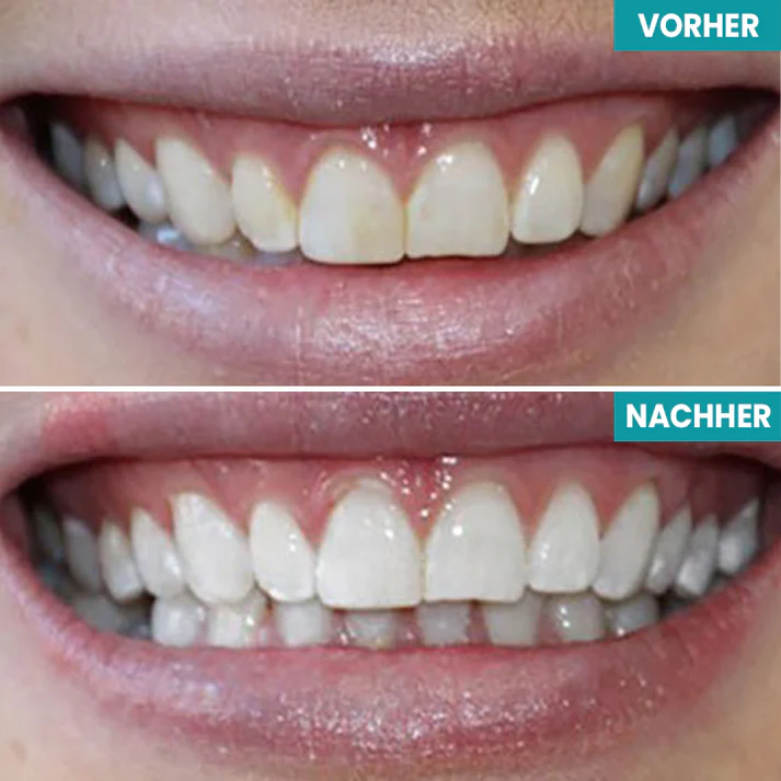 Fivfivgo® Sofortige Zahnaufhellungsfarbe