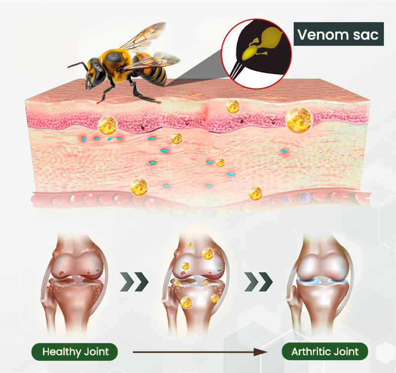 NovaRX® Bee Venom Bone & Joint Revive Spray