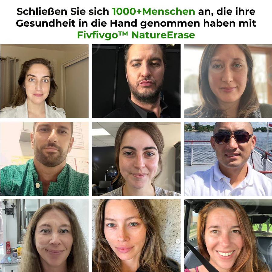 ✅ Offizieller Laden: Fivfivgo™ NatureErase Sofortige Maulwurf- und Fleckencreme