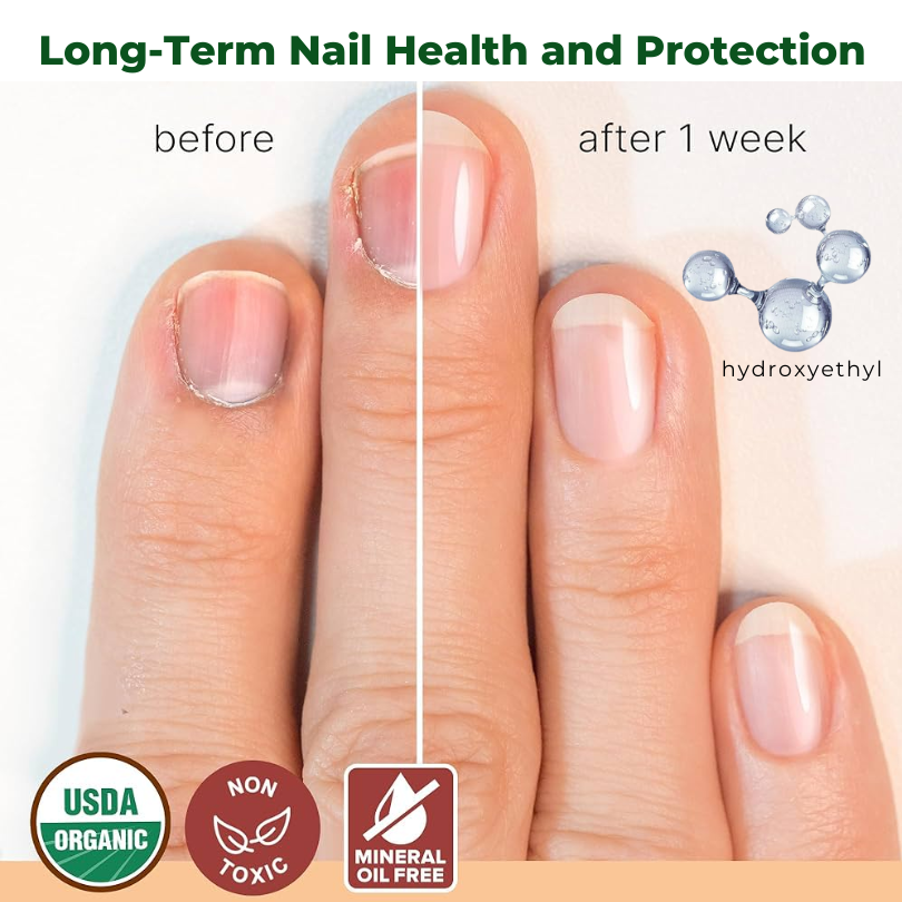 Fivfivgo™ NailNurture Bienengift Fungus Behandlungsöl