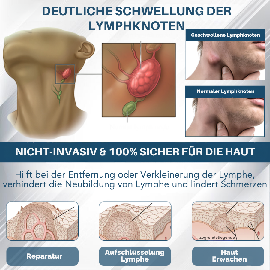 Fivfivgo® Schwarzkümmel Ödeme lindernde Kräutercreme