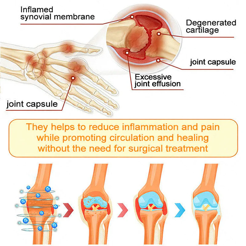 NovaRX®  Bee Venom Pain-Relief Joint Soothing Spray
