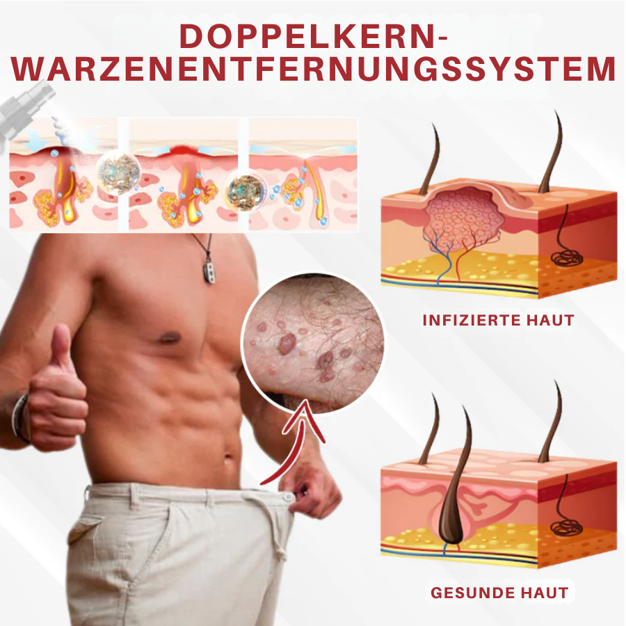Fivfivgo® Männer HPV Warzen Pflege Spray