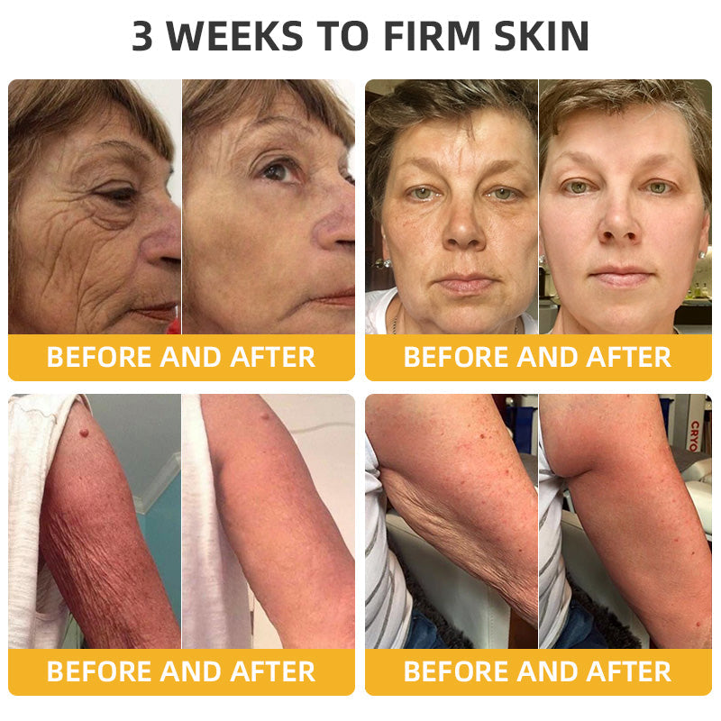 Fivfivgo™ BeeLift Anti-Aging Firming Cream (Address Crepe & Sagging) 🔥 LAST DAY SALE 70% OFF