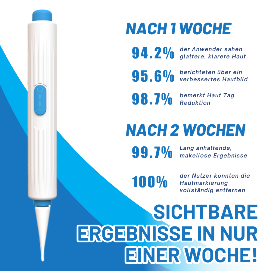 Fivfivgo™ Zu Hause Haut Tag Einfädeln Stift