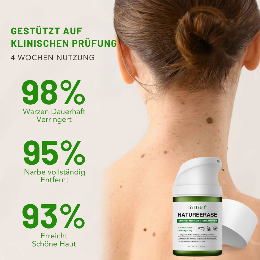 ✅ Offizieller Laden: Fivfivgo™ NatureErase Sofortige Maulwurf- und Fleckencreme