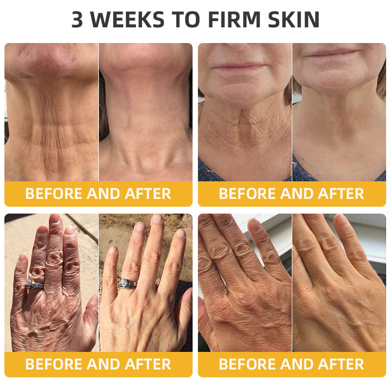 Fivfivgo™ BeeLift Anti-Aging Firming Cream (Address Crepe & Sagging) 🔥 LAST DAY SALE 70% OFF