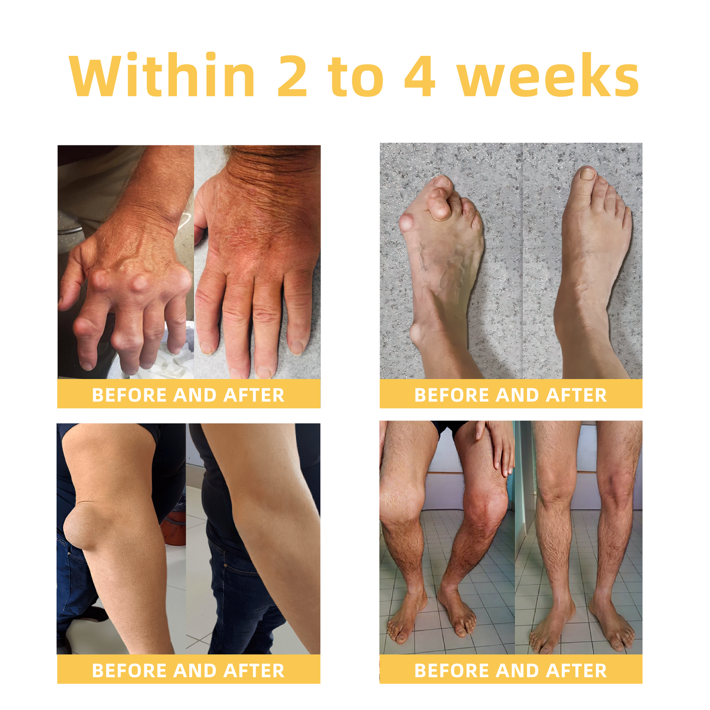 Fivfivgo™ Arthritis und Varikose Behandlung Creme