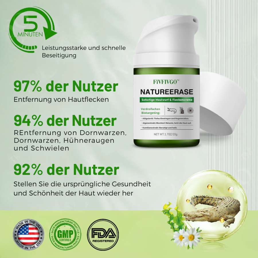 ✅ Offizieller Laden: Fivfivgo™ NatureErase Sofortige Maulwurf- und Fleckencreme